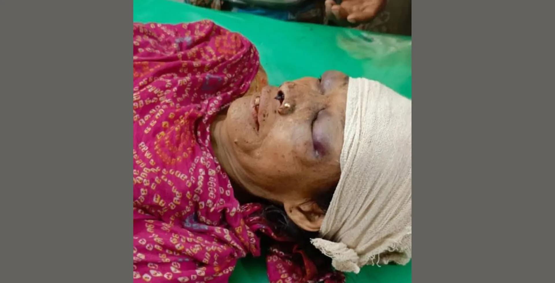 বাউফলে জমি সংক্রান্ত বিরোধকে কেন্দ্র করে হামলায় নারীর মৃত্যু 