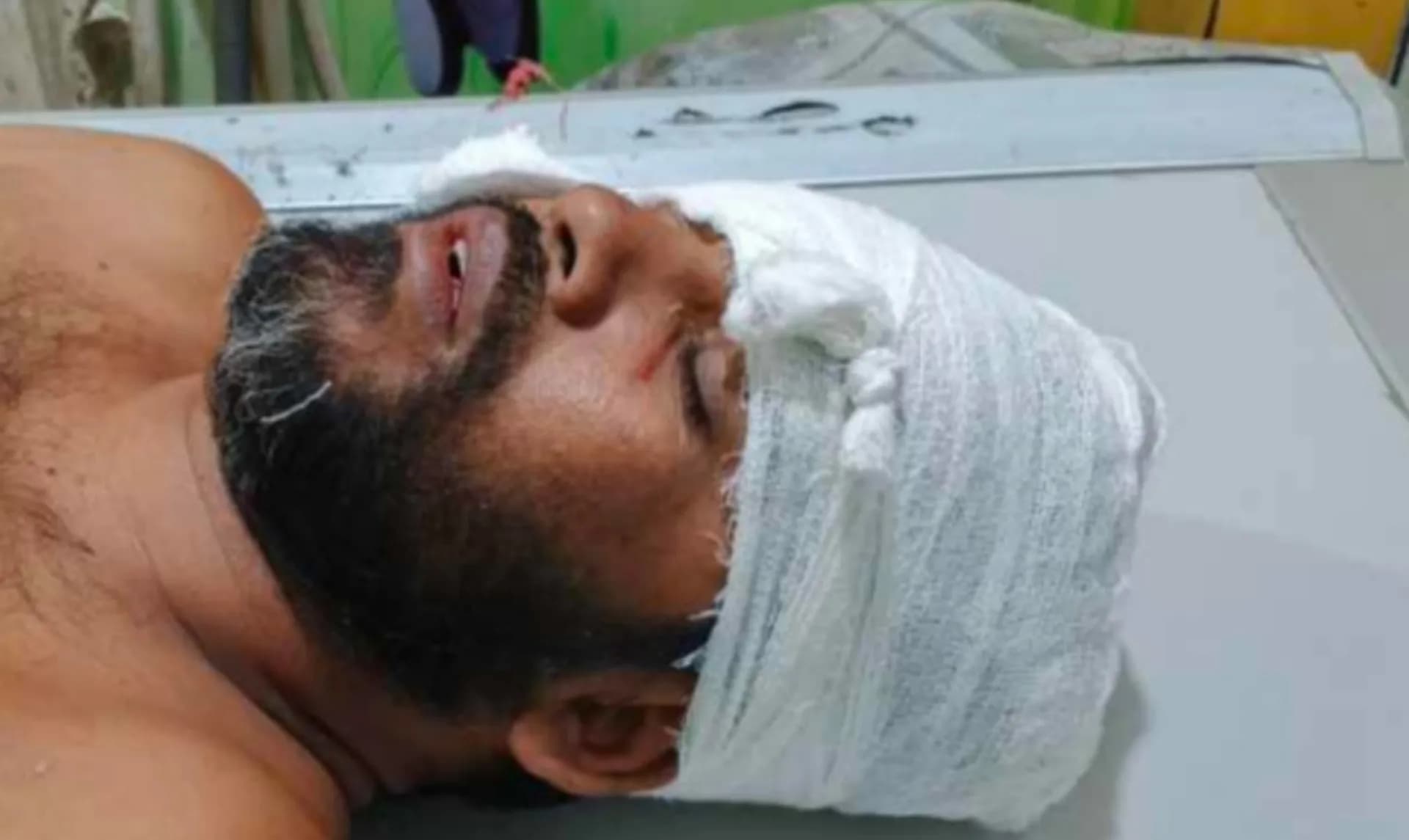 সংবাদ প্রকাশের জেরে সাংবাদিককে কুপিয়ে জখম, অবস্থা আশঙ্কাজনক