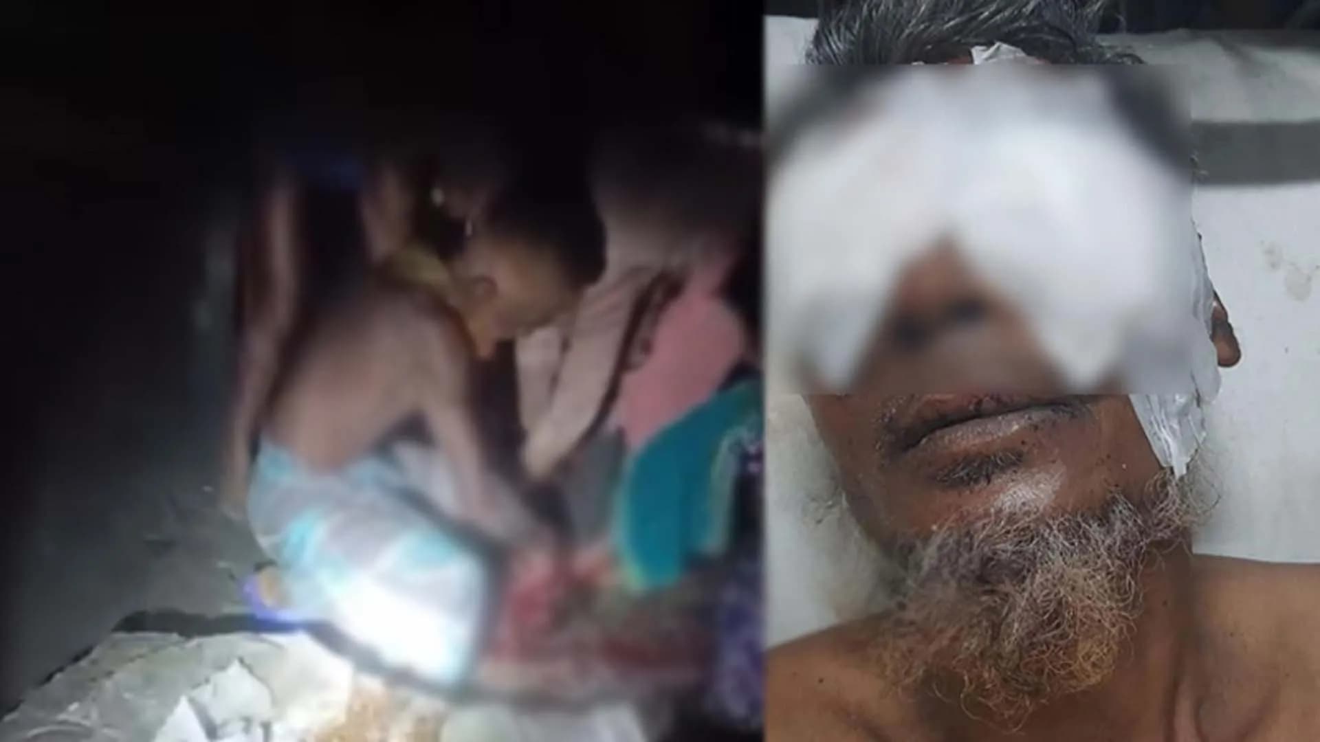 বরিশালে ভাইয়ের চোখ উঠিয়ে নেয়ার ঘটনায় অভিযুক্ত এক ভাই গ্রেপ্তার