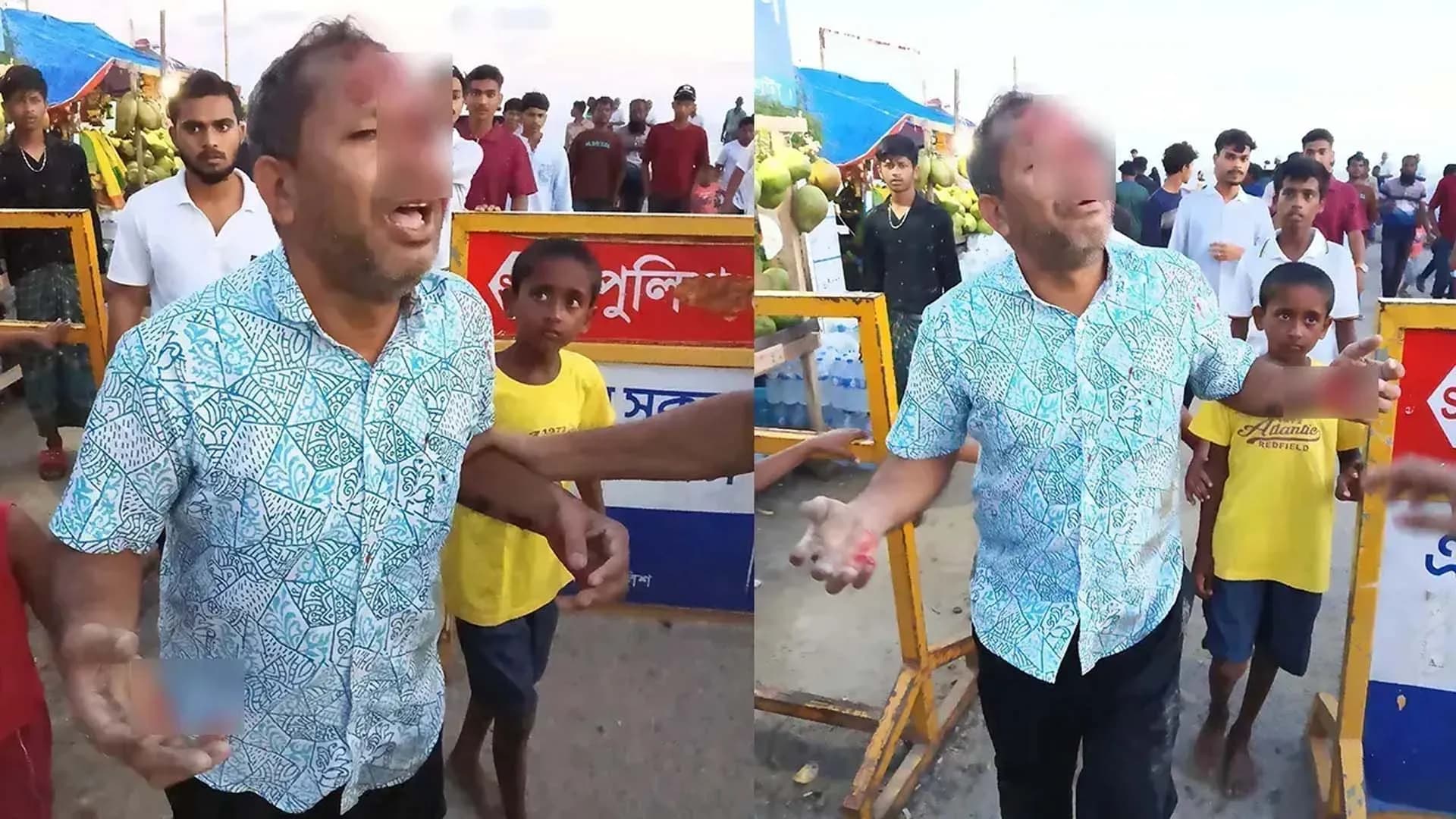 পটুয়াখালীতে মাছের ঘের নিয়ে বিরোধ, প্রকাশ্যে আইনজীবীকে পিটিয়ে জখম