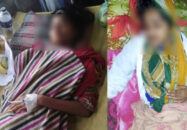 পটুয়াখালীতে বজ্রপাতের শব্দে অচেতন হয়ে দুই স্কুলছাত্রী হাসপাতলে